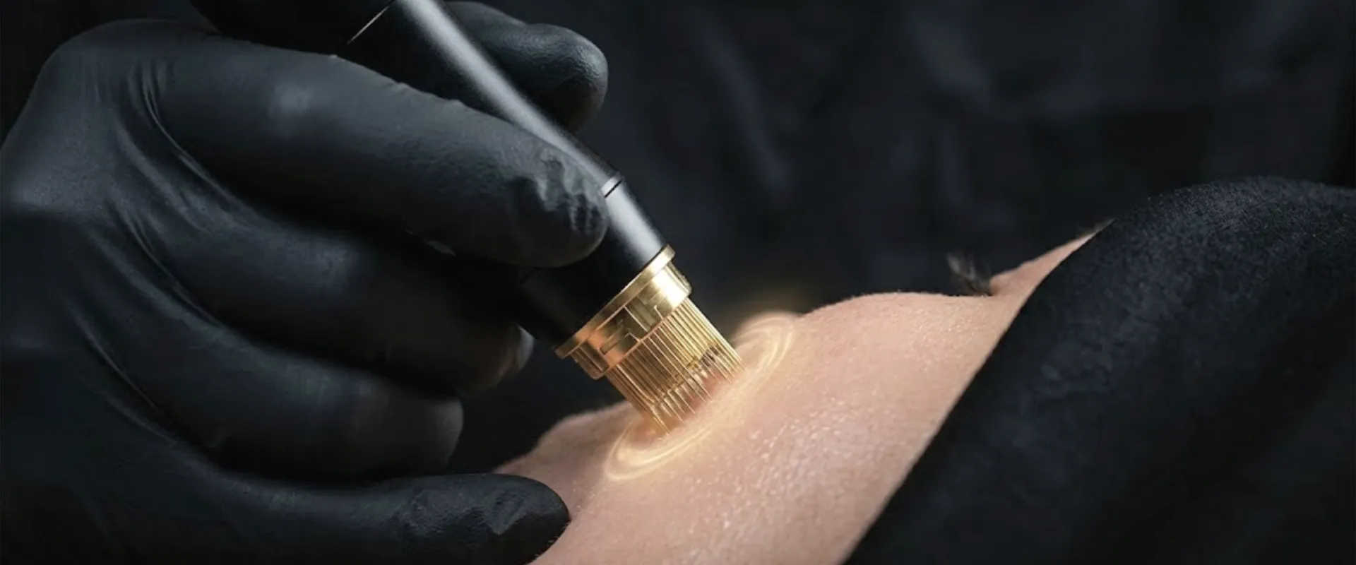 Morpheus RF-Needling Kurs München