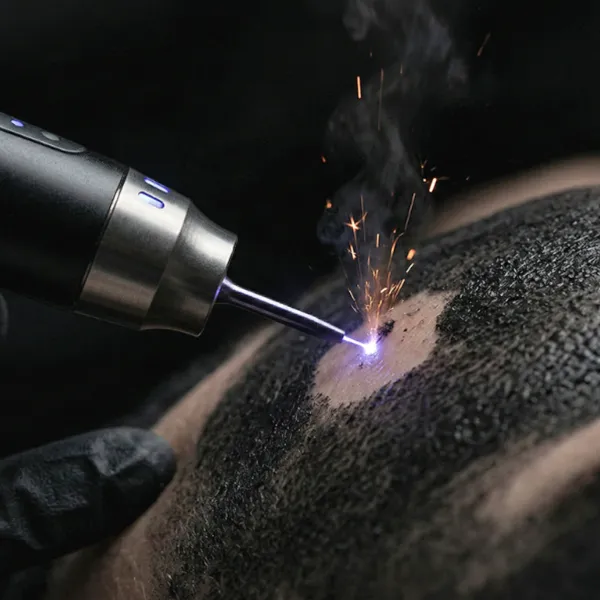 Carbon Peeling Kurs