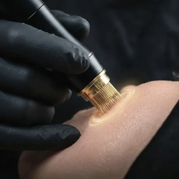Morpheus RF-Needling Kurs